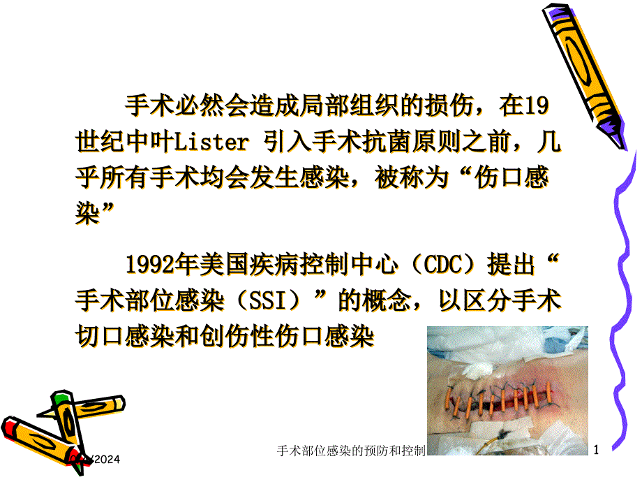 手术部位感染的预防和控制培训课件_第1页