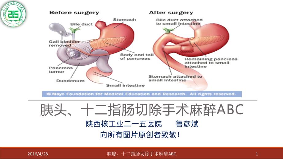 胰腺、十二指肠手术麻醉ABC-ppt参考课件_第1页