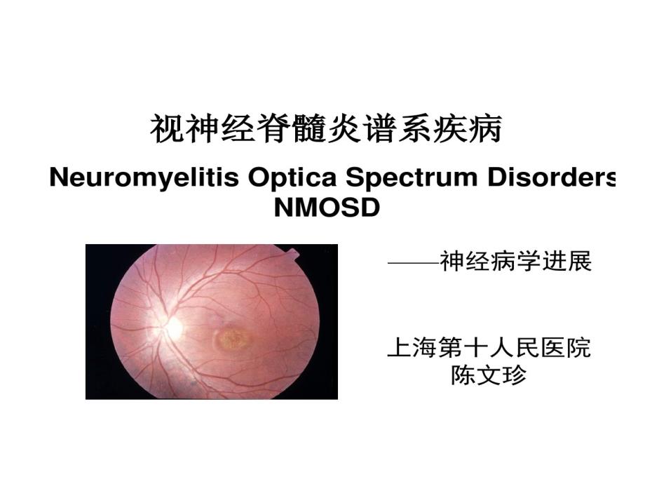 视神经脊髓炎谱系疾病课件_第1页