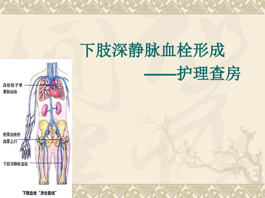 下肢深静脉血栓查房_第1页