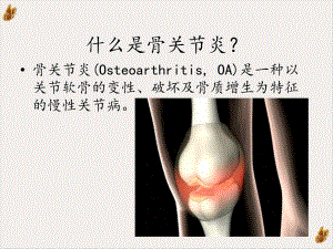 骨關(guān)節(jié)炎與骨質(zhì)疏松癥課件