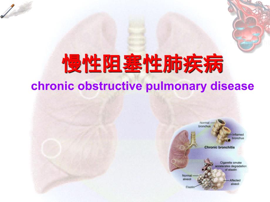 慢性阻塞性肺疾病-课件-2_第1页