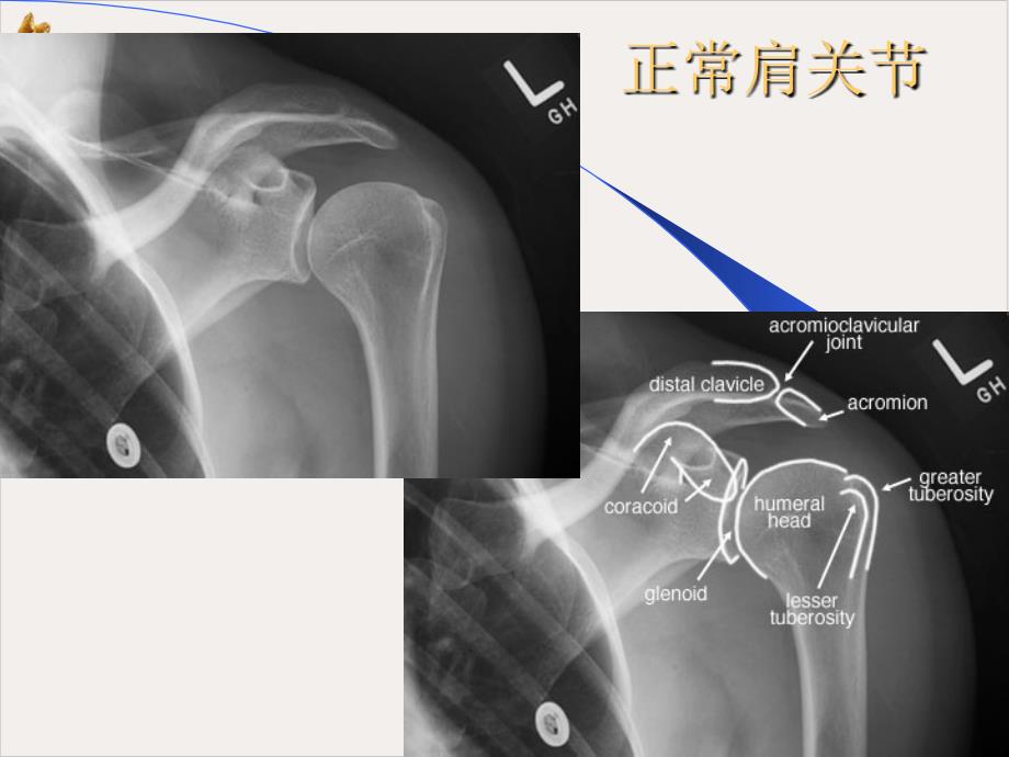 骨科X线片教学课件_第1页