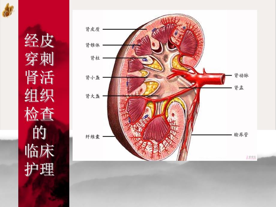 经皮穿刺肾活组织检查的 ppt课件_第1页