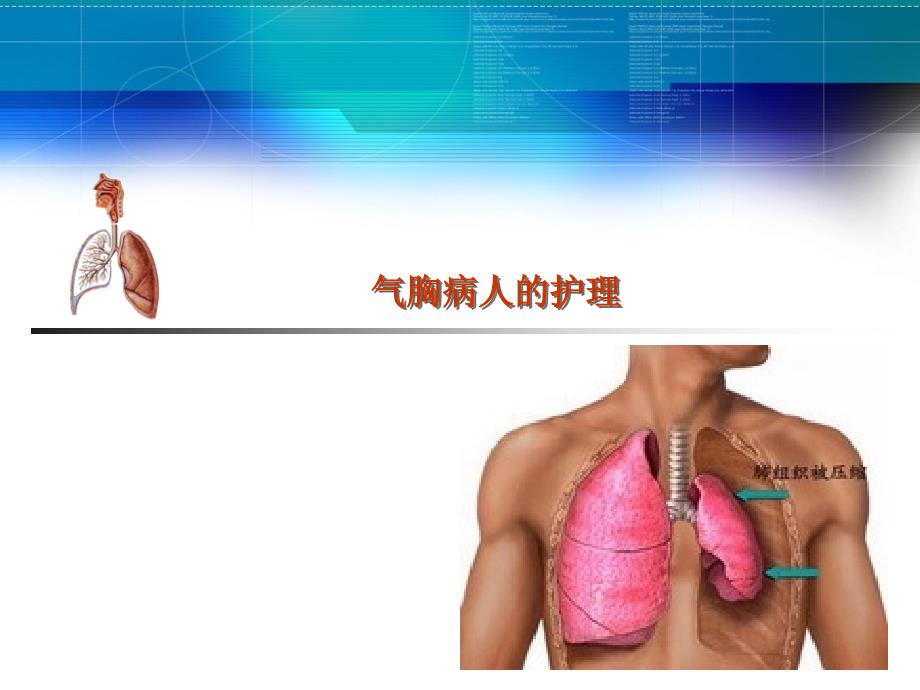 自发性气胸患者的护理_第1页