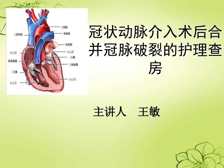 冠状动脉介入治疗的护理查房ppt课件_第1页