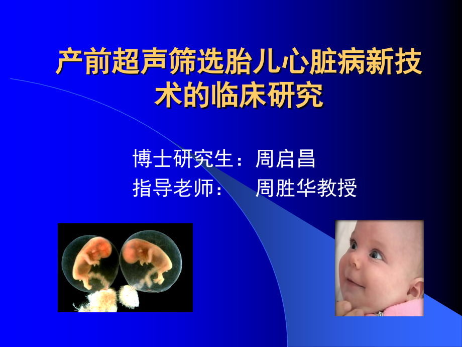 产前超声筛选胎儿心脏病新技术的周启昌2006湘雅_第1页