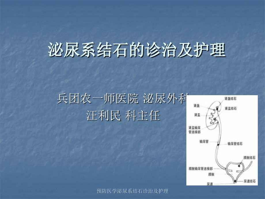 预防医学泌尿系结石诊治及护理课件_第1页