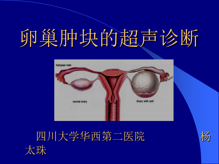 卵巢肿块的超声诊断杨太珠华西_第1页