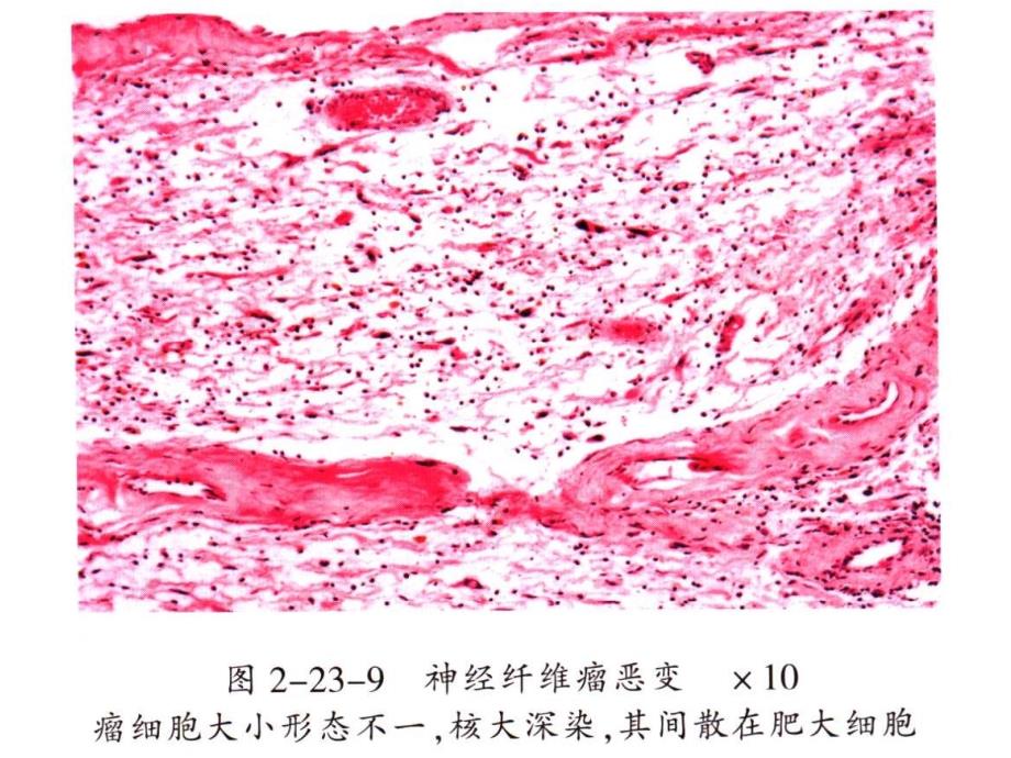 医学皮肤组织病理学彩色图谱（六）_第1页