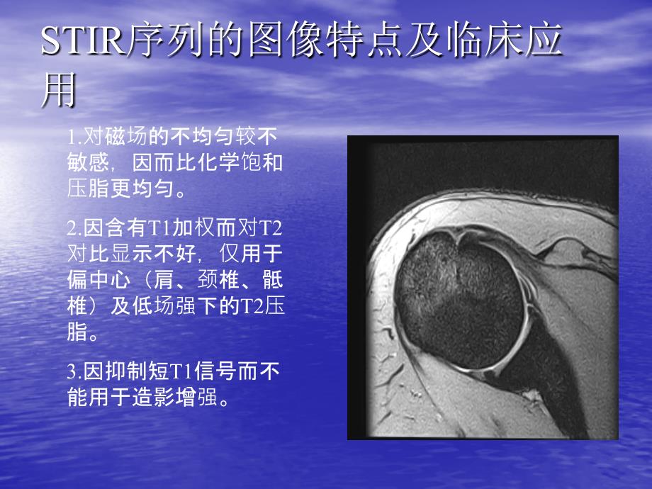 MRI成像序列2_第1页