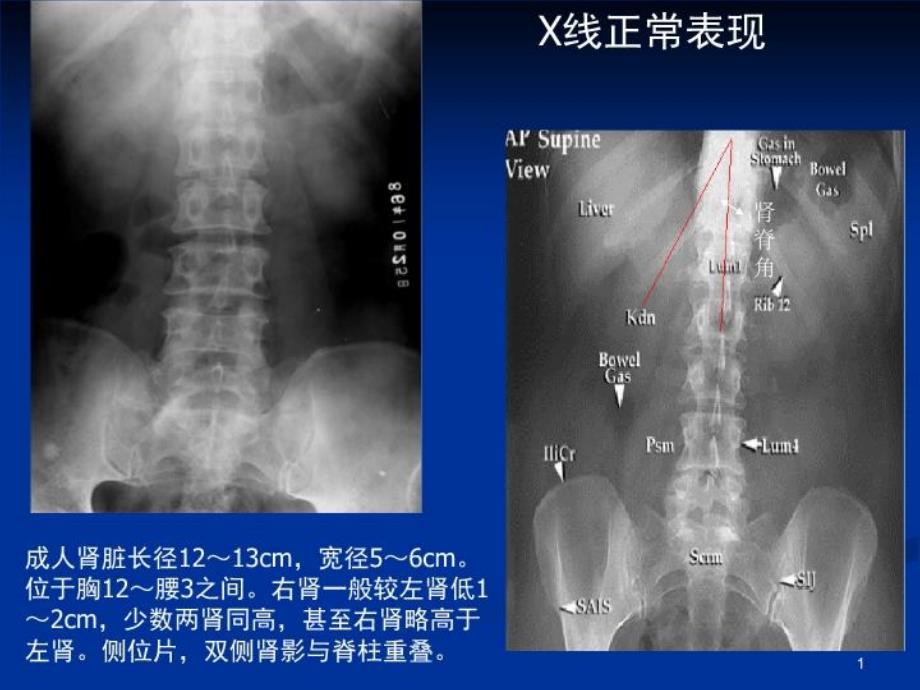 《泌尿系统影像》PPT课件_第1页