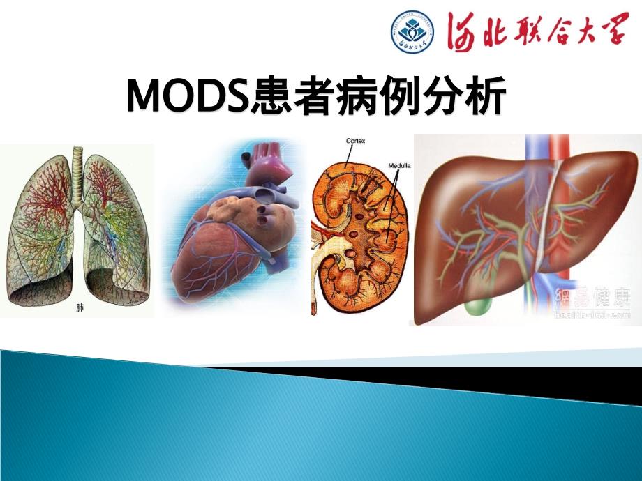 MODS病例分析解读_第1页