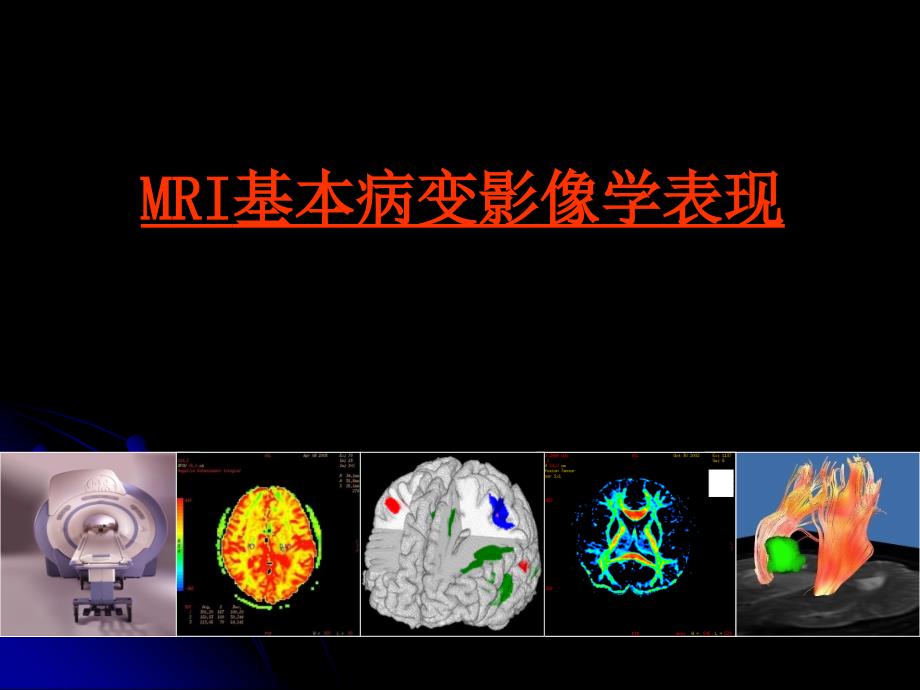 MRI基本病变影像学表现_第1页