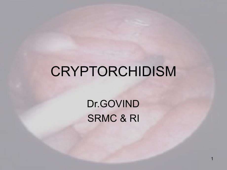 CRYPTORCHIDISM_第1页