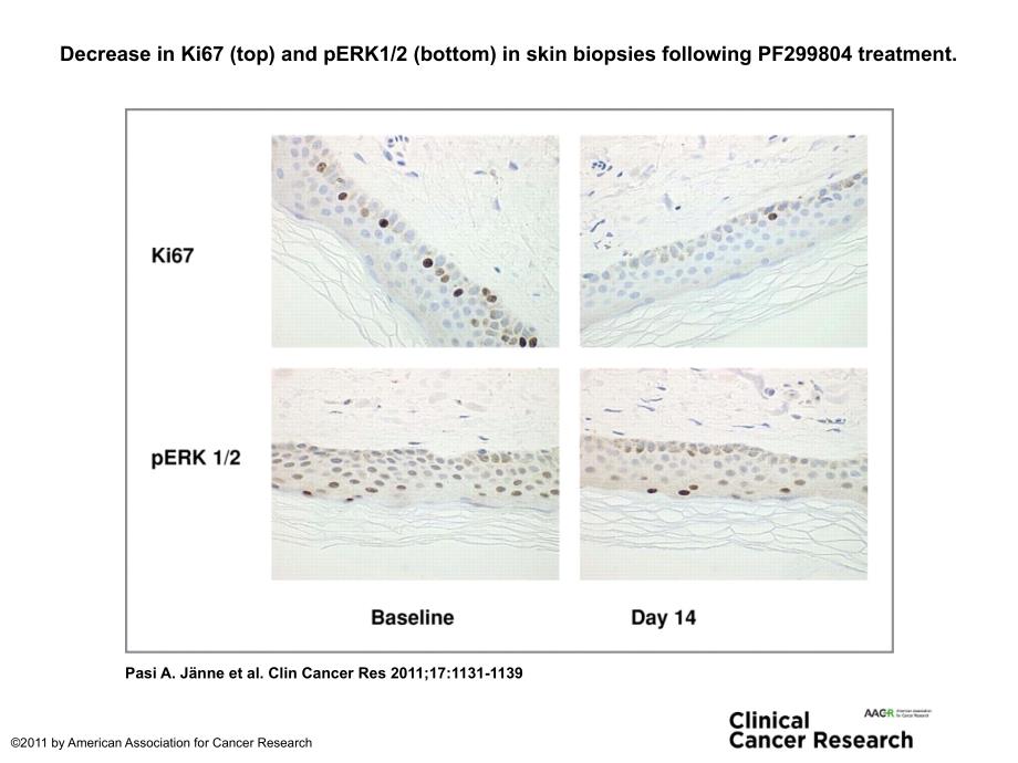 DecreaseinKi67(top)andpERK12(bottom)inskinbiopsies_第1页