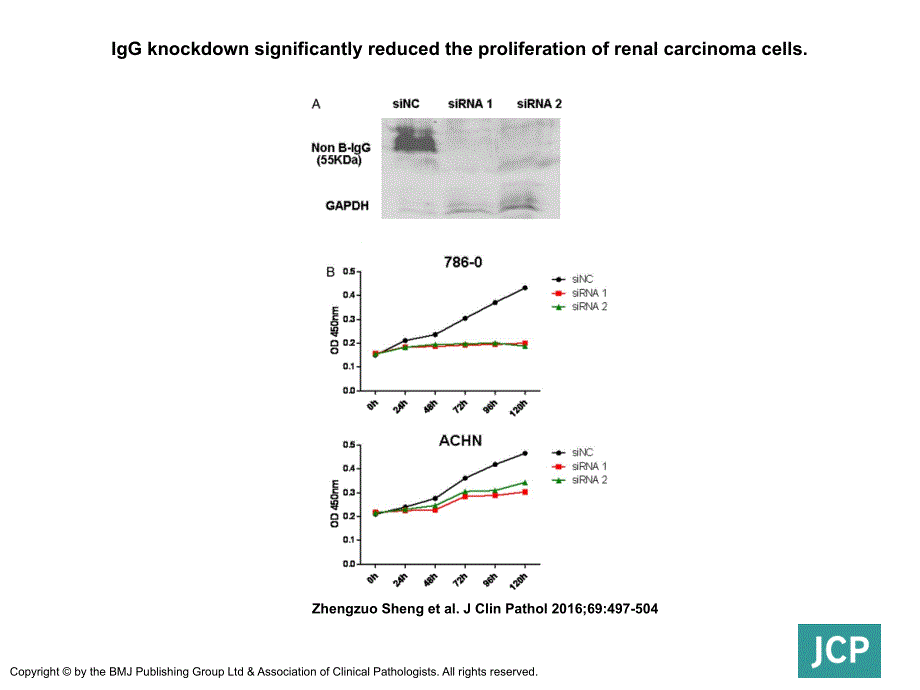 IgGknockdownsignificantlyreducedtheproliferationofrenal_第1页