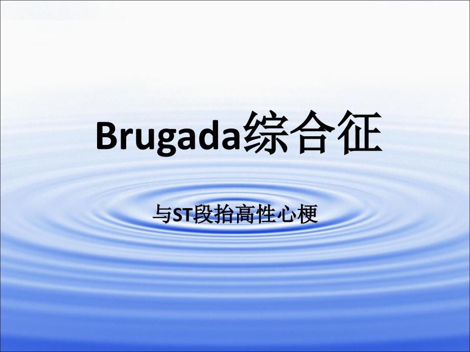 Brugada综合征_第1页