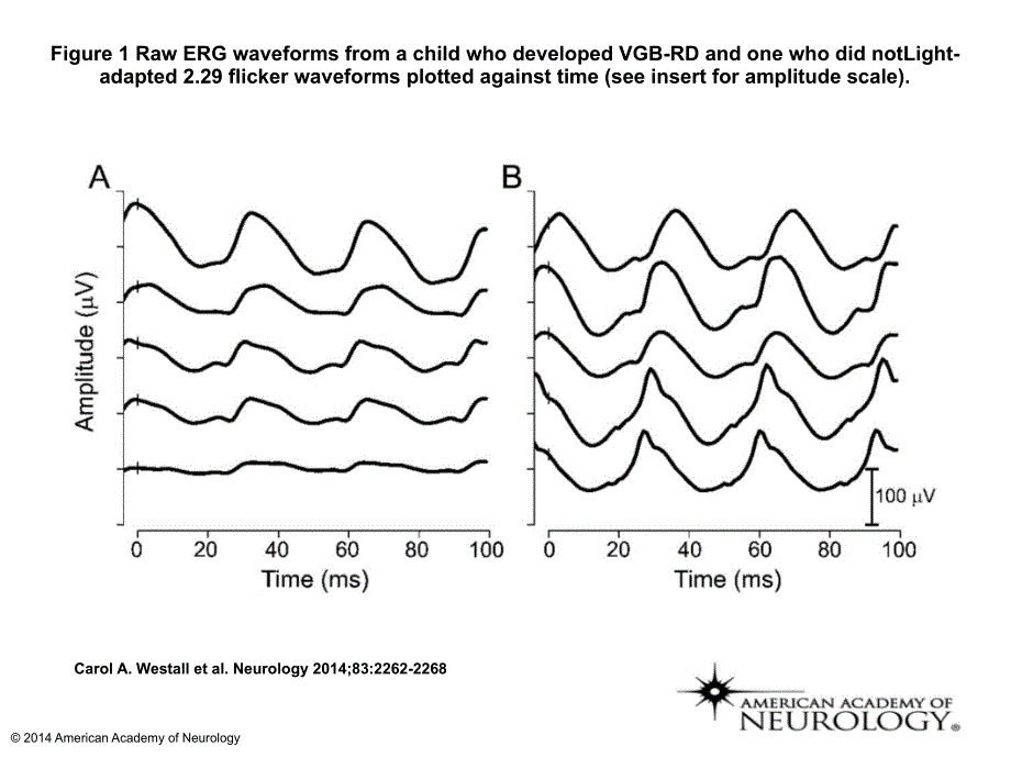 Figure1RawERGwaveformsfromachildwhodeveloped_第1页