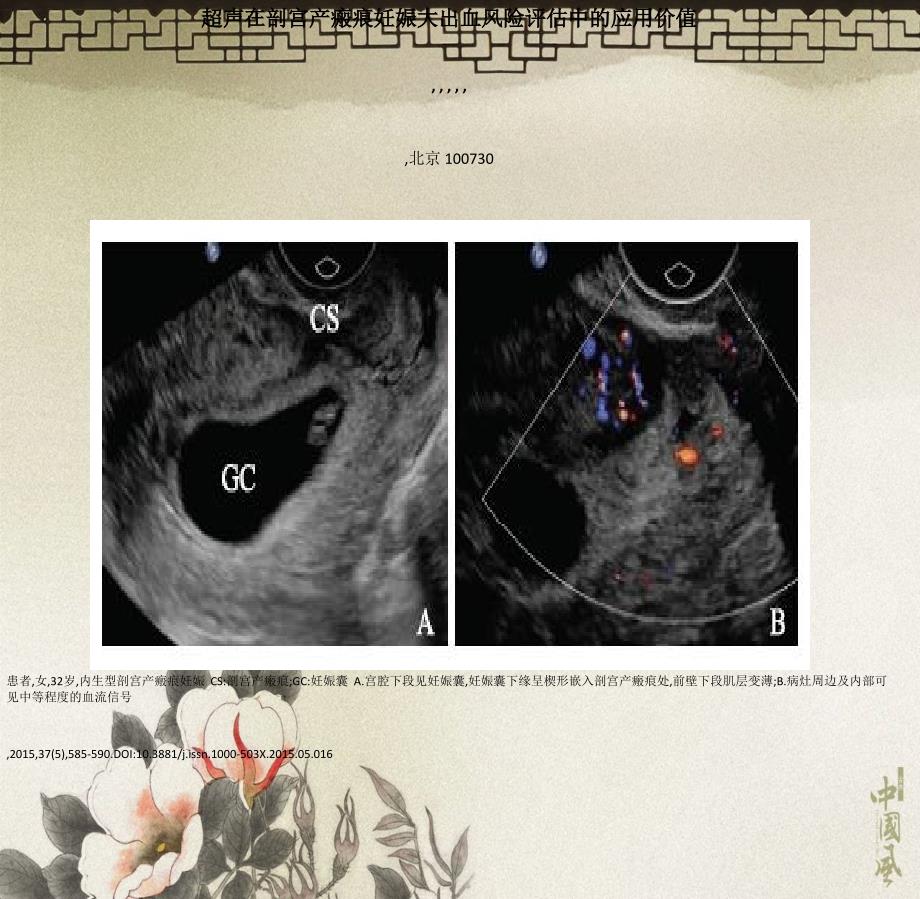 超声在剖宫产瘢痕妊娠大出血风险评估中的应用价值_第1页