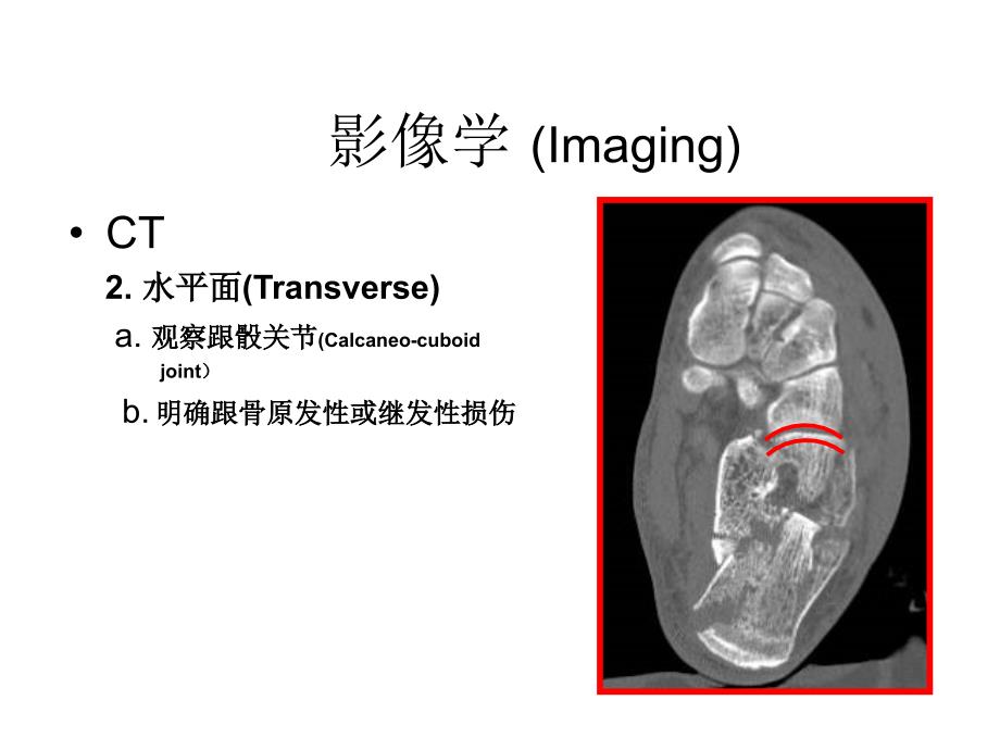 跟骨骨折影像学_第1页