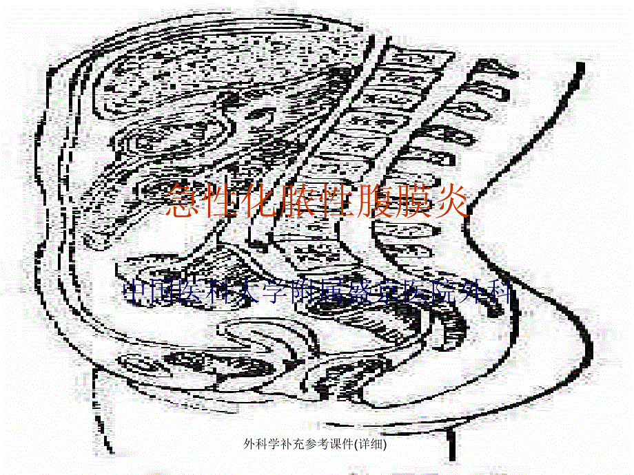 外科学补充参考课件(详细)课件_第1页