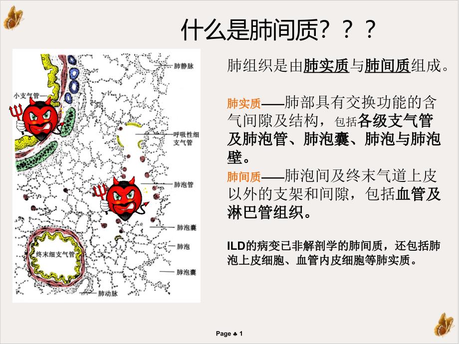 间质性肺炎ppt课件_第1页