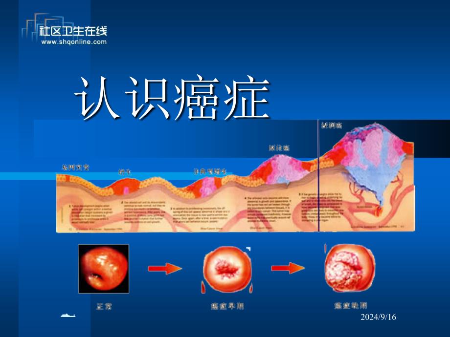 肺癌胃癌和食道癌等62种恶性肿瘤课件_第1页