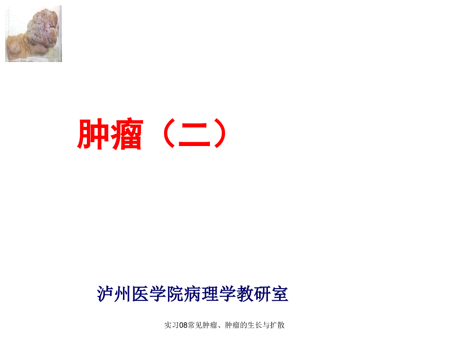 实习08常见肿瘤、肿瘤的生长与扩散课件_第1页