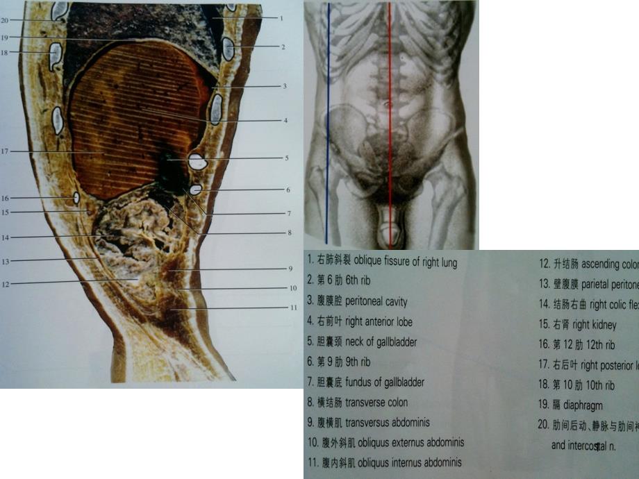 人体断面解剖图谱10-腹部矢状断面_第1页