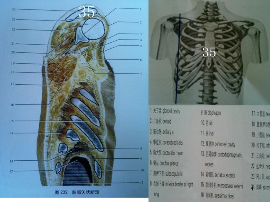 人体断面解剖图谱07胸部矢状断面_第1页