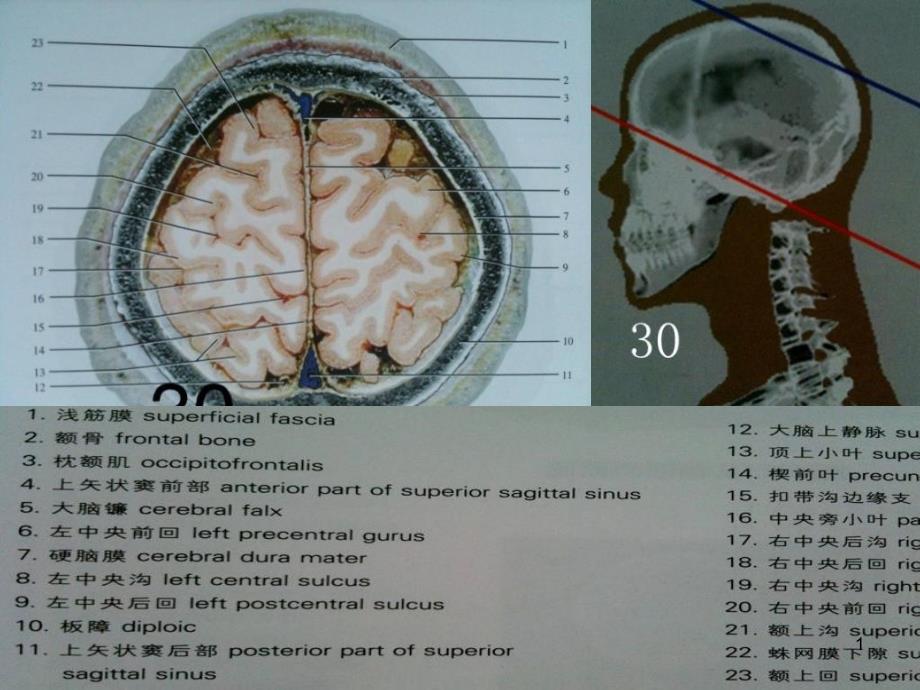 人体断面解剖图谱02头颅斜断面_第1页