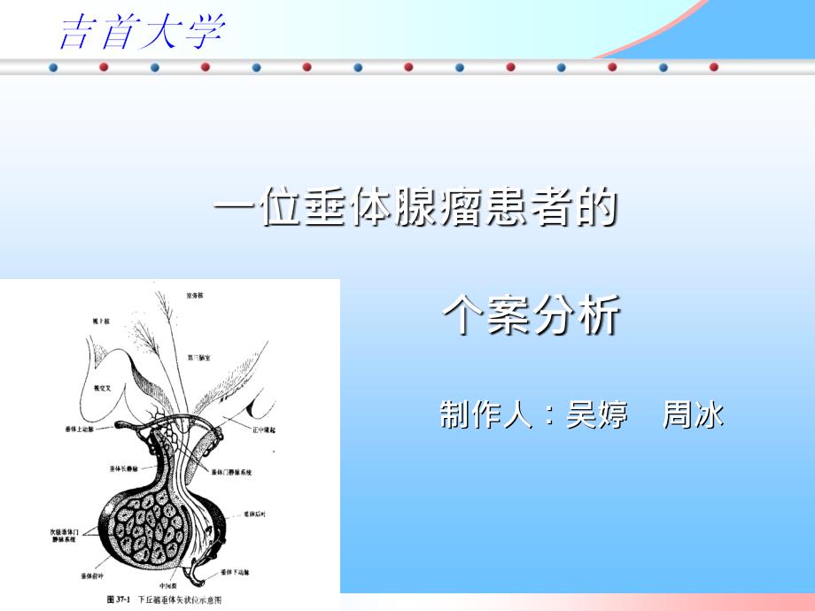 垂体腺瘤患者个案护理课件_第1页