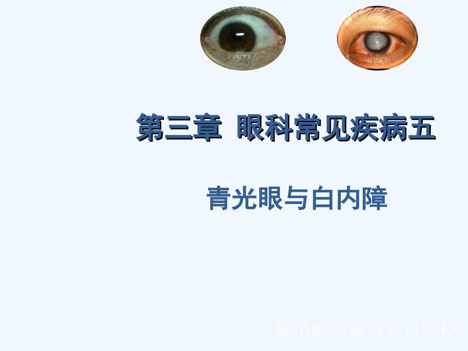 五官科学第三章眼科常见疾病5青光眼与白内障_第1页