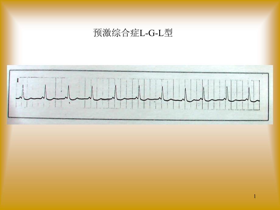 心电图及影像考试题答案_第1页