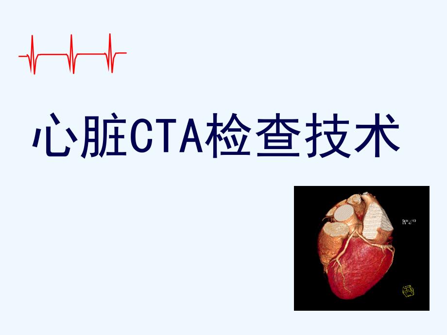 心脏CTA检查_第1页