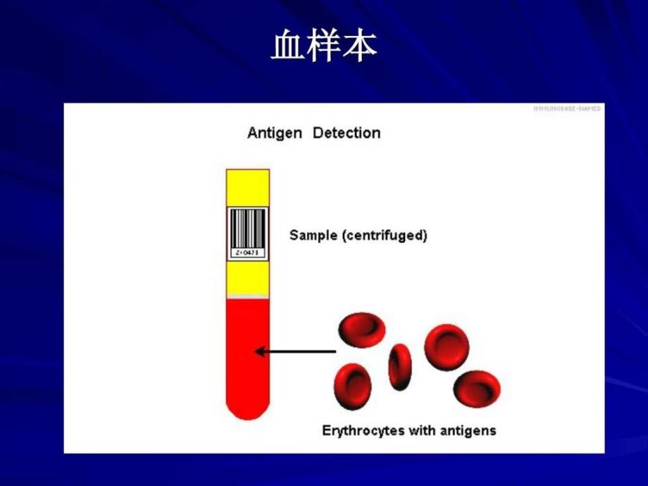 ABO血型鉴定试验._第1页