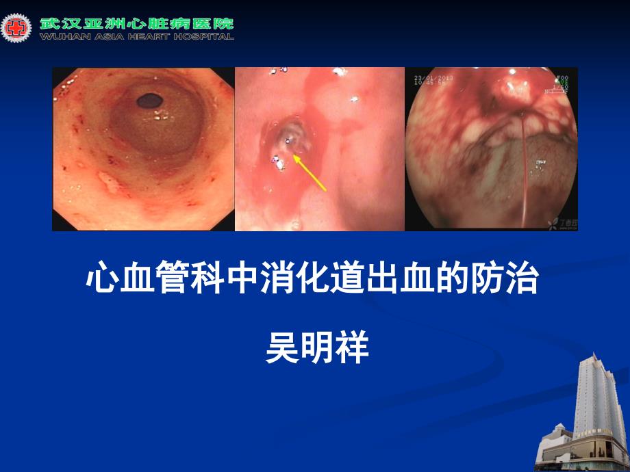 心血管疾病中消化道出血防治ppt课件_第1页