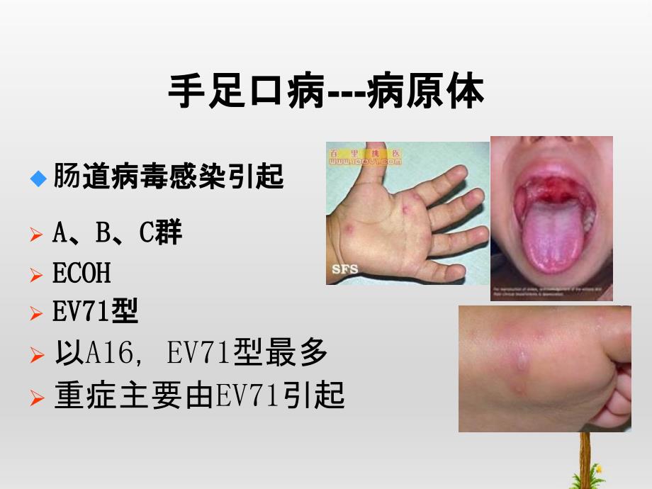 手足口病重症诊治中的相关问题_第1页