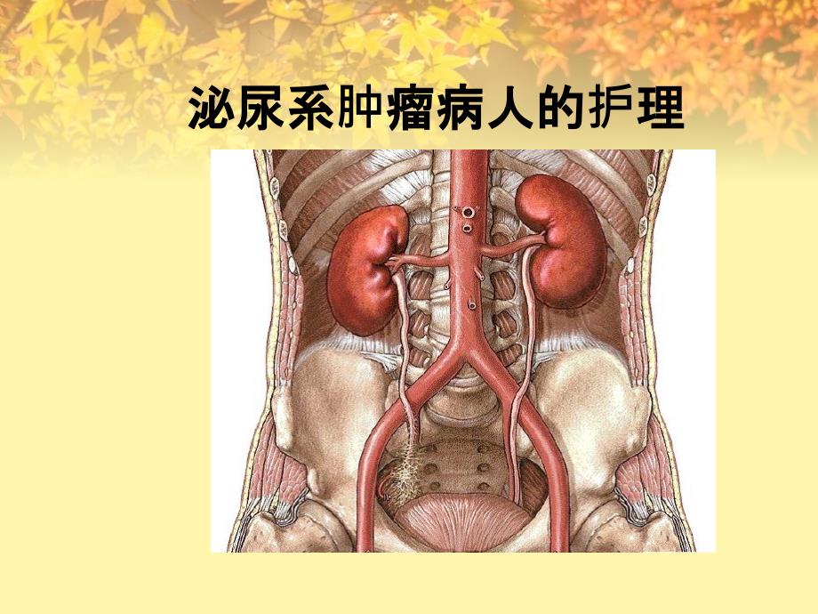 教学情境三十八泌尿系肿瘤病人的护理_第1页