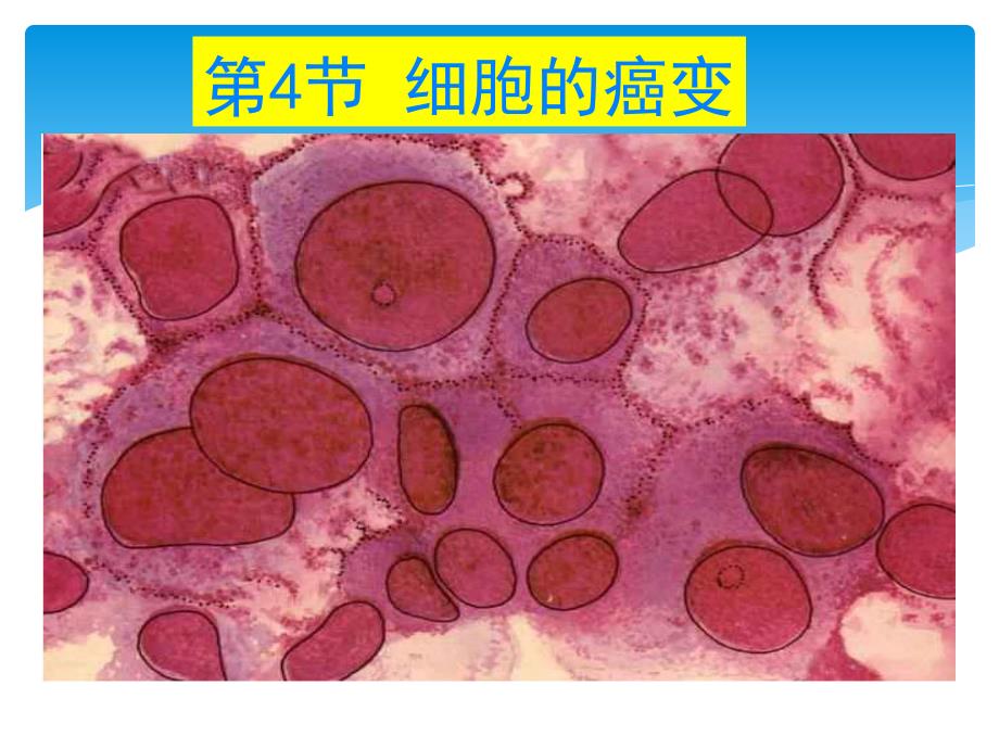 生物必修细胞癌变PPT课件_第1页