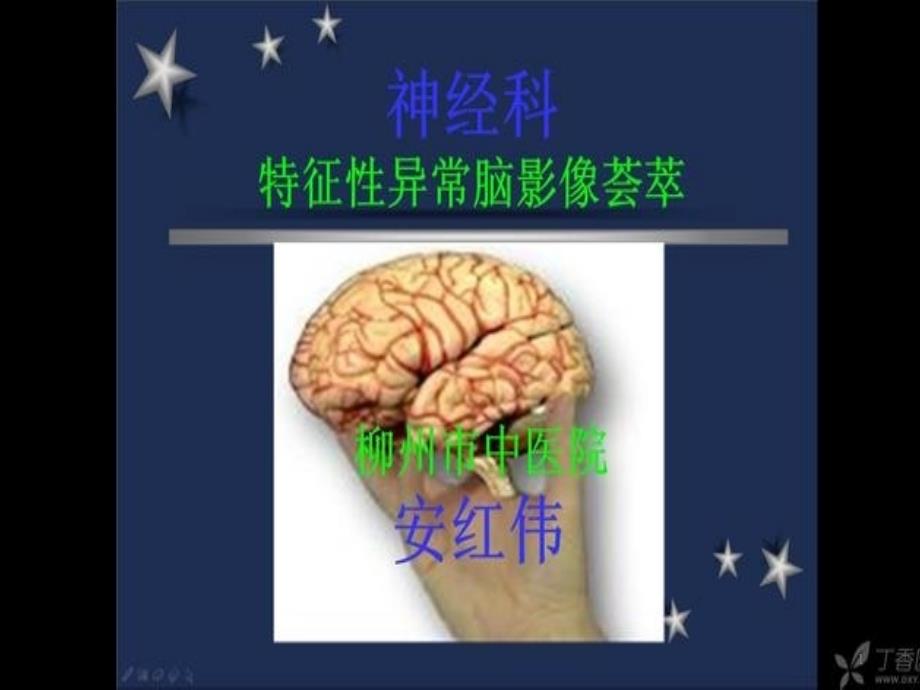 神经内科影像_第1页