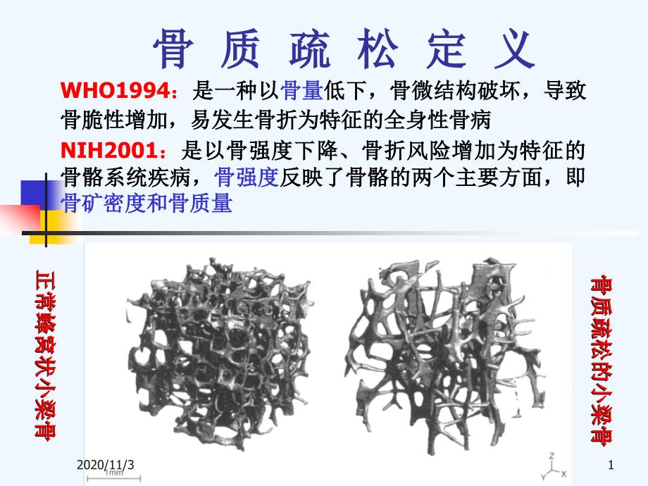 骨质疏松症的中西医结合治疗_第1页