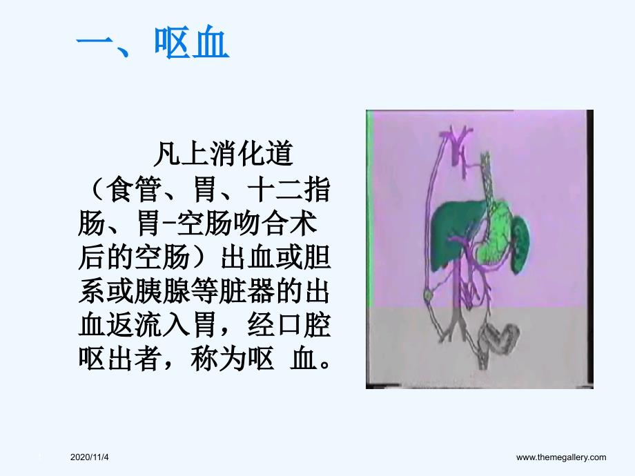 临床医学呕血与便血_第1页