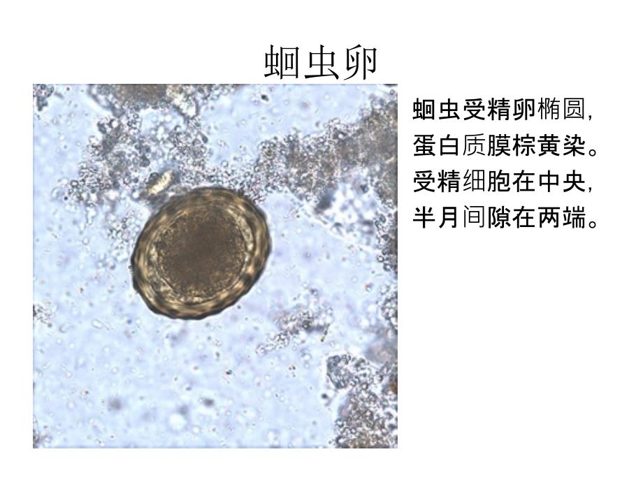 寄生虫学虫卵经典总结及图片_第1页