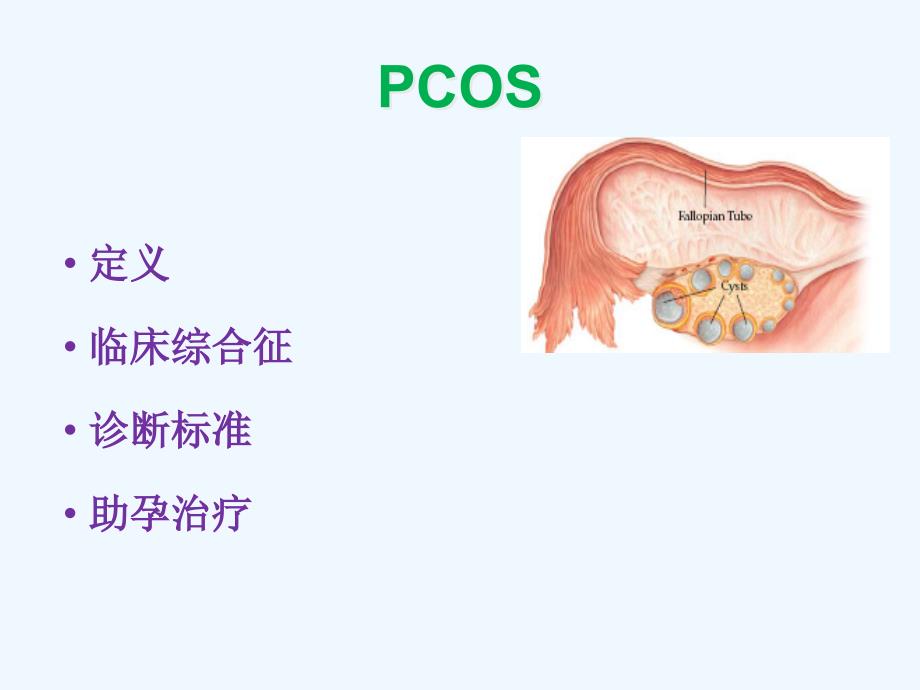 PCOS与异常子宫出血_第1页