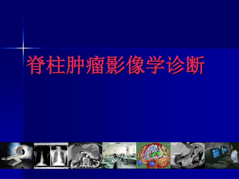 推荐医学影像诊断PPT课件详解完整版脊柱肿瘤影像学诊断_第1页