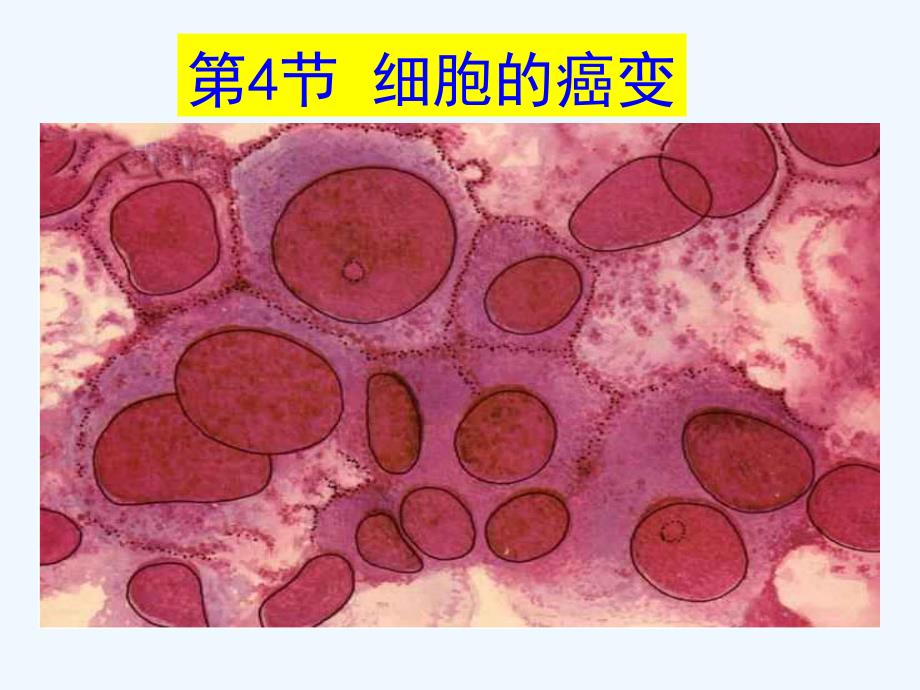 生物必修细胞癌变PPT课件_第1页