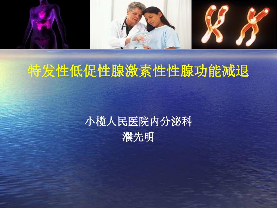 特发性低促性腺激素性性腺功能减退_第1页