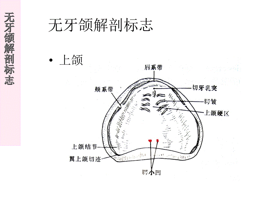 无牙颌解剖标志_第1页